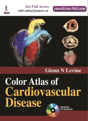 bokomslag Color Atlas of Cardiovascular Disease