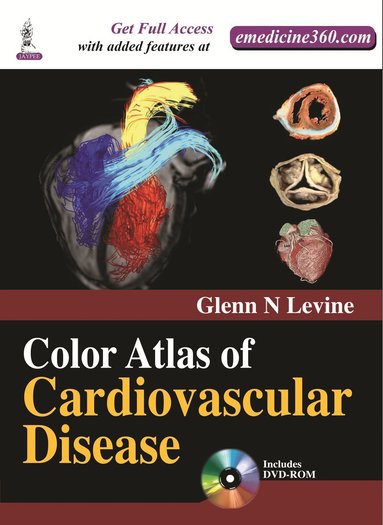 bokomslag Color Atlas of Cardiovascular Disease