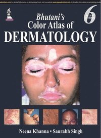 bokomslag Bhutani's  Color Atlas of Dermatology