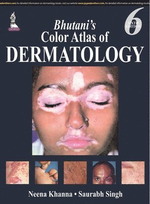 Neena Khanna - Bhutani’s  Color Atlas of Dermatology, Inbunden