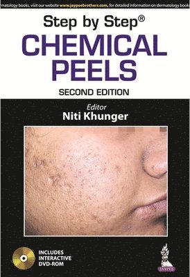 Step by Step: Chemical Peels 1