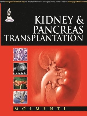 bokomslag Kidney & Pancreas Transplantation