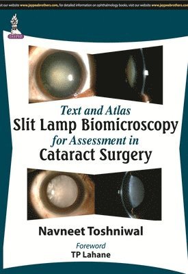Navneet Toshniwal - Text and Atlas: Slit Lamp Biomicroscopy for Assessment in Cataract Surgery, Häftad