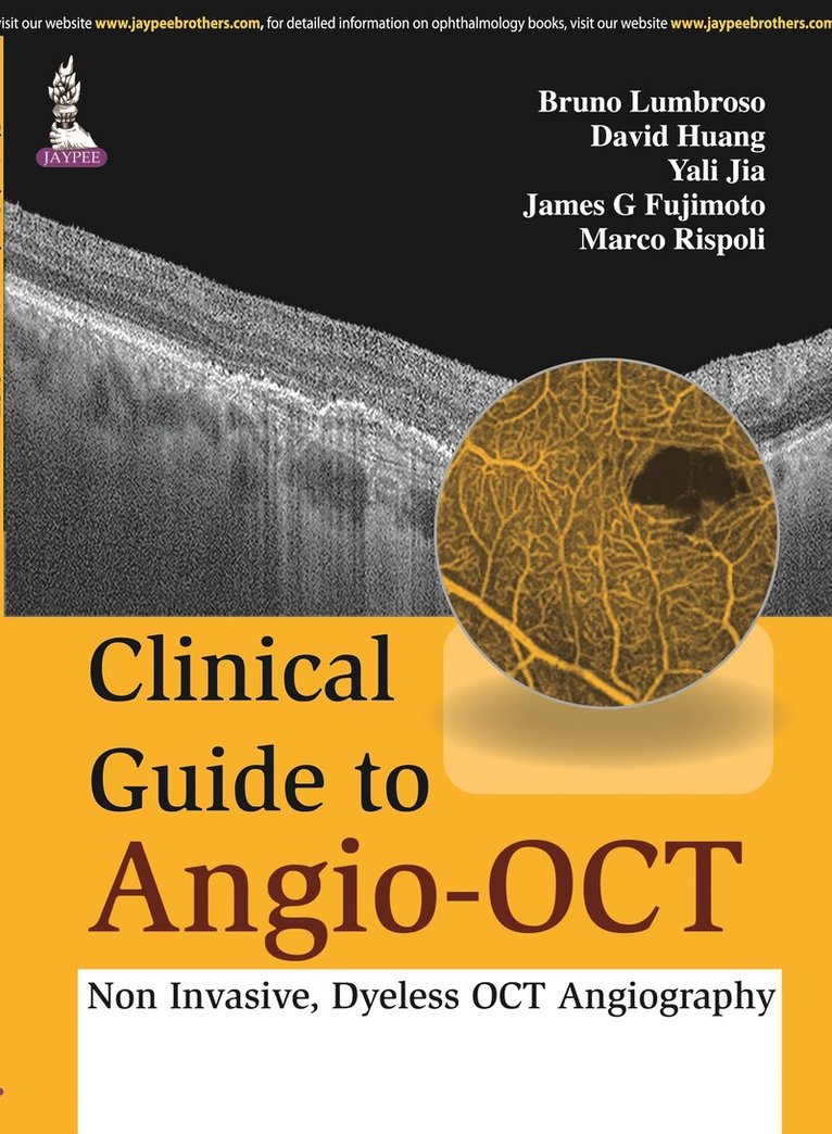 Bruno Lumbroso, David Huang, Yali Jia, James G Fujimoto, Marco Rispoli - Clinical Guide to Angio-OCT: Non Invasive, Dyeless OCT Angiography, Inbunden