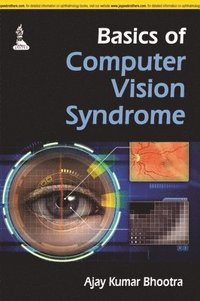 bokomslag Basics of Computer Vision Syndrome