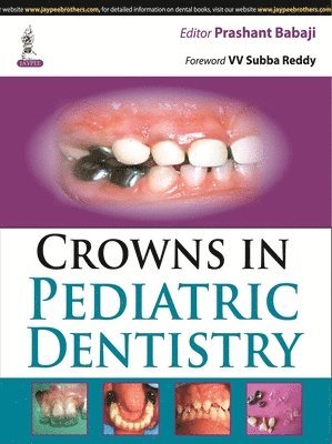 bokomslag Crowns in Pediatric Dentistry