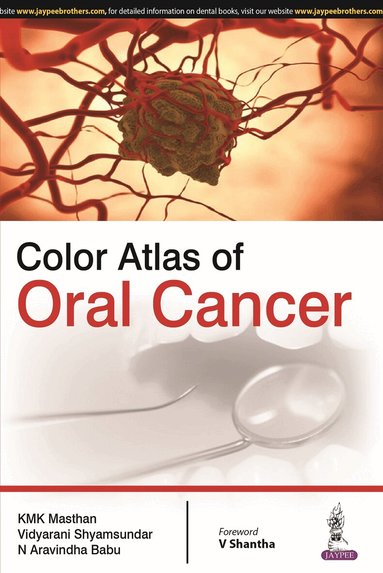 KMK Masthan, Vidyarani Shyamsundar, N Aravindha Babu - Color Atlas of Oral Cancer, Häftad