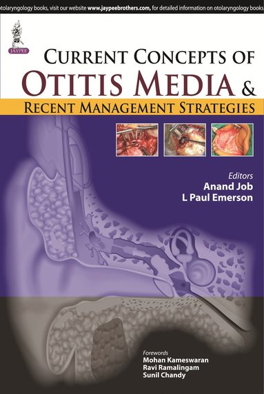 bokomslag Current Concepts of Otitis Media and Recent Management Strategies