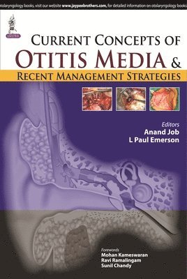 Current Concepts of Otitis Media and Recent Management Strategies 1