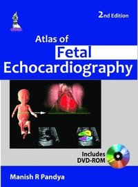bokomslag Atlas of Fetal Echocardiography