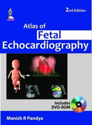 Manish R Pandya - Atlas of Fetal Echocardiography, Inbunden
