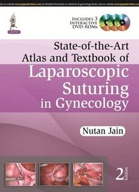 bokomslag State-of-the-Art Atlas and Textbook of Laparoscopic Suturing in Gynecology