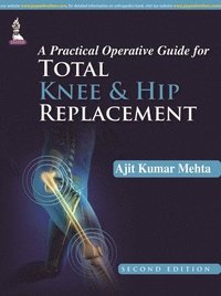 bokomslag A Practical Operative Guide for Total Knee and Hip Replacement