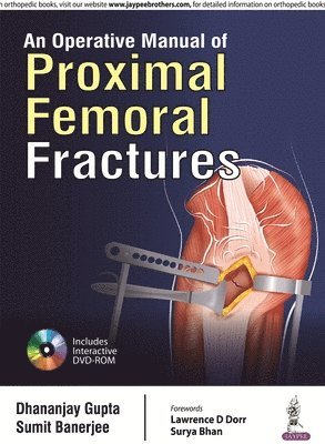 bokomslag An Operative Manual of Proximal Femoral Fractures