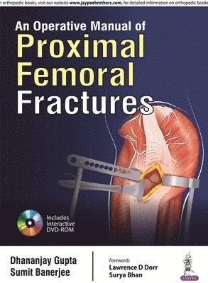 An Operative Manual of Proximal Femoral Fractures 1