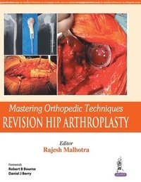 bokomslag Mastering Orthopedic Techniques: Revision Total Hip Arthroplasty