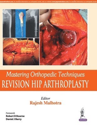 Rajesh Malhotra - Mastering Orthopedic Techniques: Revision Total Hip Arthroplasty, Inbunden