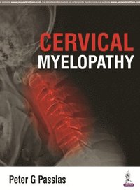 bokomslag Cervical Myelopathy