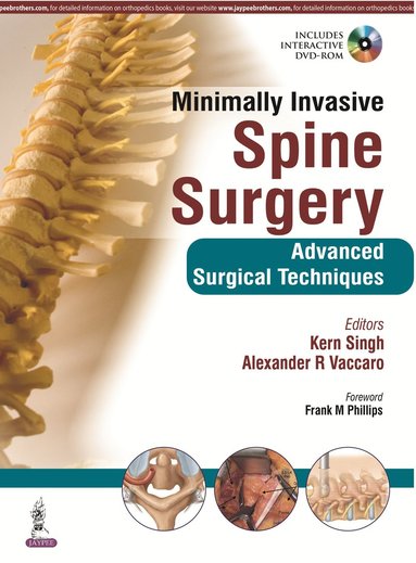 bokomslag Minimally Invasive Spine Surgery