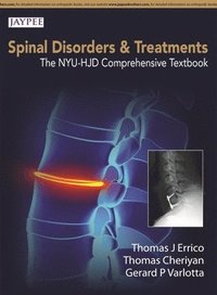 bokomslag Spinal Disorders & Treatment: The NYU-HJD Comprehensive Textbook