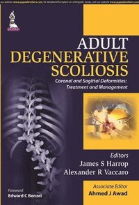 bokomslag Adult Degenerative Scoliosis