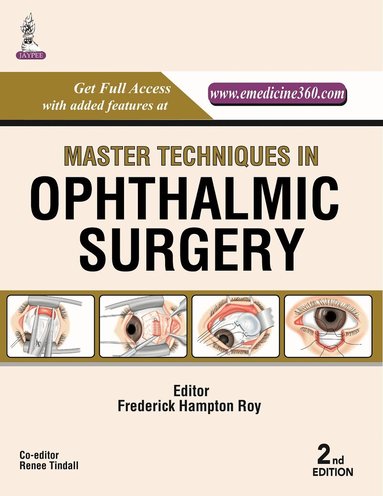 Frederick Hampton Roy - Master Techniques in Ophthalmic Surgery, Inbunden