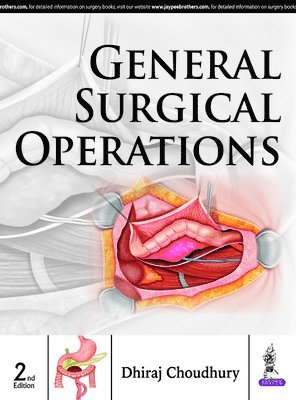 bokomslag General Surgical Operations