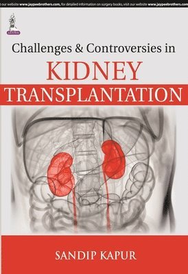 bokomslag Challenges and Controversies in Kidney Transplantation