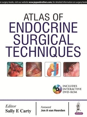 Atlas of Endocrine Surgical Techniques 1