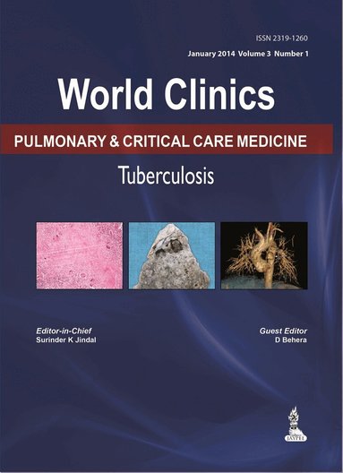 Surinder K Jindal, D Behera - World Clinics: Pulmonary & Critical Care Medicine - Tuberculosis, Volume 3, No: 1, Inbunden