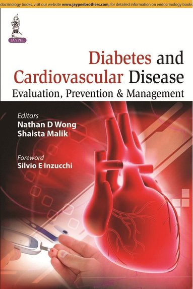 bokomslag Diabetes and Cardiovascular Disease: Evaluation, Prevention & Management