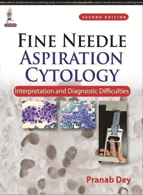 bokomslag Fine Needle Aspiration Cytology: Interpretation and Diagnostic Difficulties