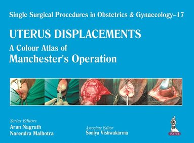 Arun Nagrath, Narendra Malhotra, Soniya Vishwakarma - Single Surgical Procedures in Obstetrics and Gynaecology – 17 - UTERUS DISPLACEMENTS, Inbunden