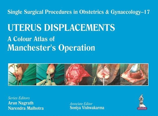 Single Surgical Procedures in Obstetrics and Gynaecology - 17 - UTERUS DISPLACEMENTS 1