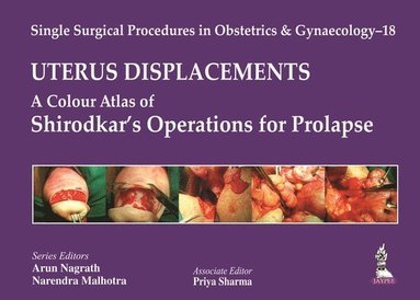 bokomslag Single Surgical Procedures in Obstetrics and Gynaecology - 18: UTERUS DISPLACEMENTS: A Colour Atlas of Shirodkar's Operations for Prolapse