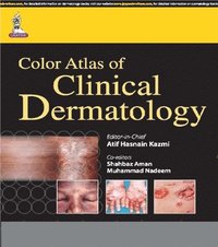 bokomslag Color Atlas of Clinical Dermatology