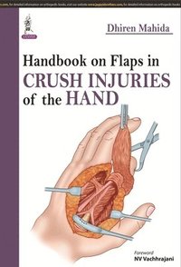 bokomslag Handbook on Flaps in Crush Injuries of the Hand