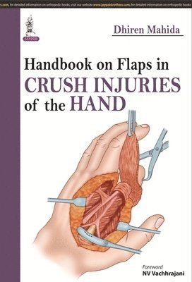 bokomslag Handbook on Flaps in Crush Injuries of the Hand