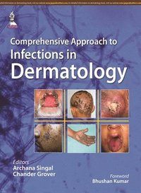 bokomslag Comprehensive Approach to Infections in Dermatology