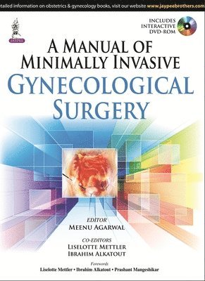 Meenu Agarwal, Liselotte Mettler, Ibrahim Alkatout - Manual of Minimally Invasive Gynecological Surgery, Häftad