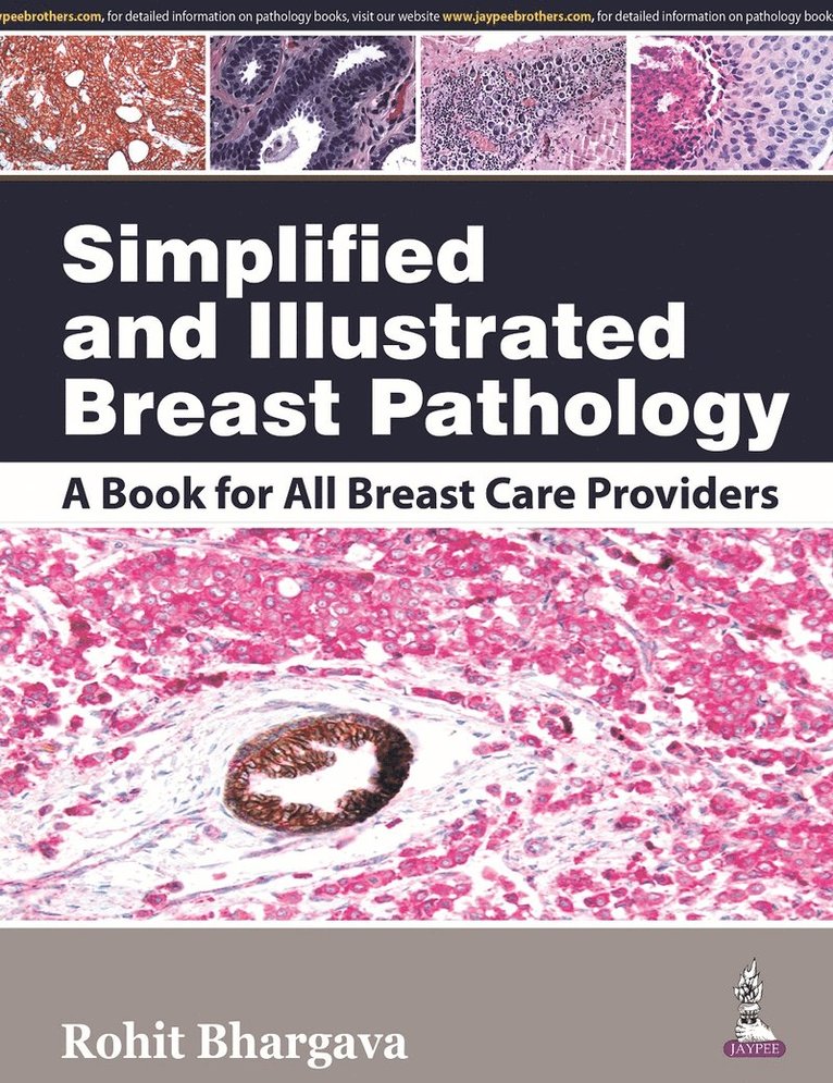 Rohit Bhargava - Simplified and Illustrated Breast Pathology, Inbunden