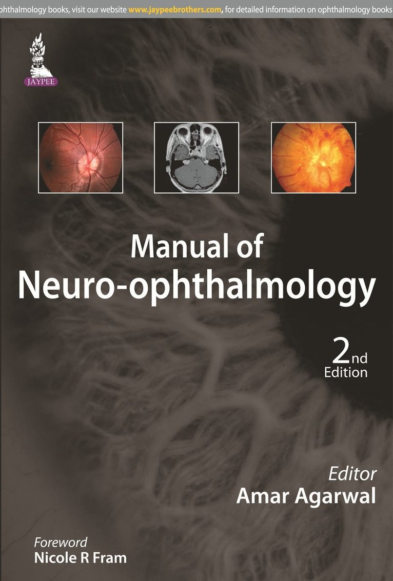 Amar Agarwal - Manual of Neuro-ophthalmology, Häftad