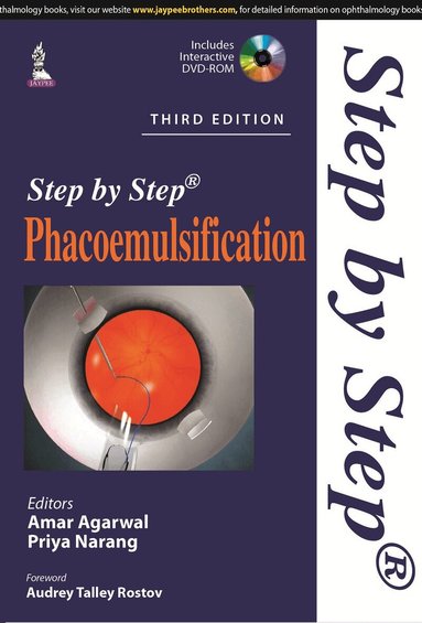 Amar Agarwal, Priya Narang - Step by Step Phacoemulsification, Häftad