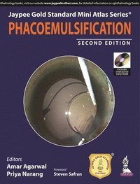 bokomslag Jaypee Gold Standard Mini Atlas Series: Phacoemulsification