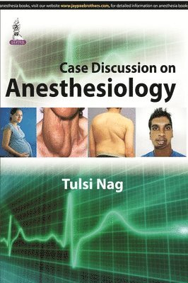 Tulsi Nag - Case Discussion on Anesthesiology, Häftad