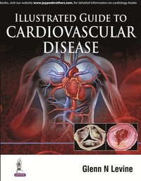 bokomslag Illustrated Guide to Cardiovascular Disease