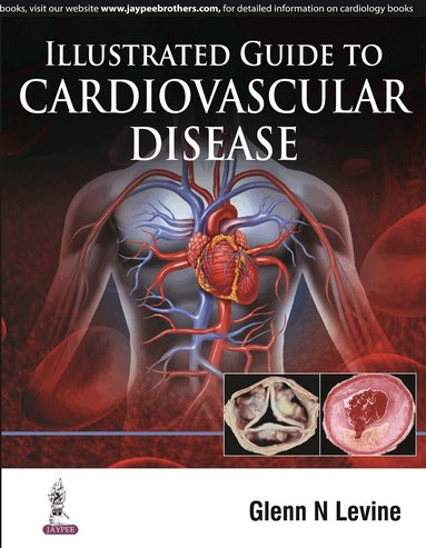 Glenn N Levine - Illustrated Guide to Cardiovascular Disease, Inbunden