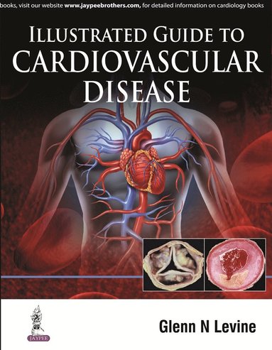 bokomslag Illustrated Guide to Cardiovascular Disease