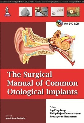 bokomslag Surgical Manual of Common Otological Implants
