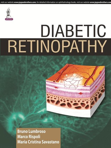 Bruno Lumbroso, Marco Rispoli, Maria Cristina Savastano - Diabetic Retinopathy, Inbunden